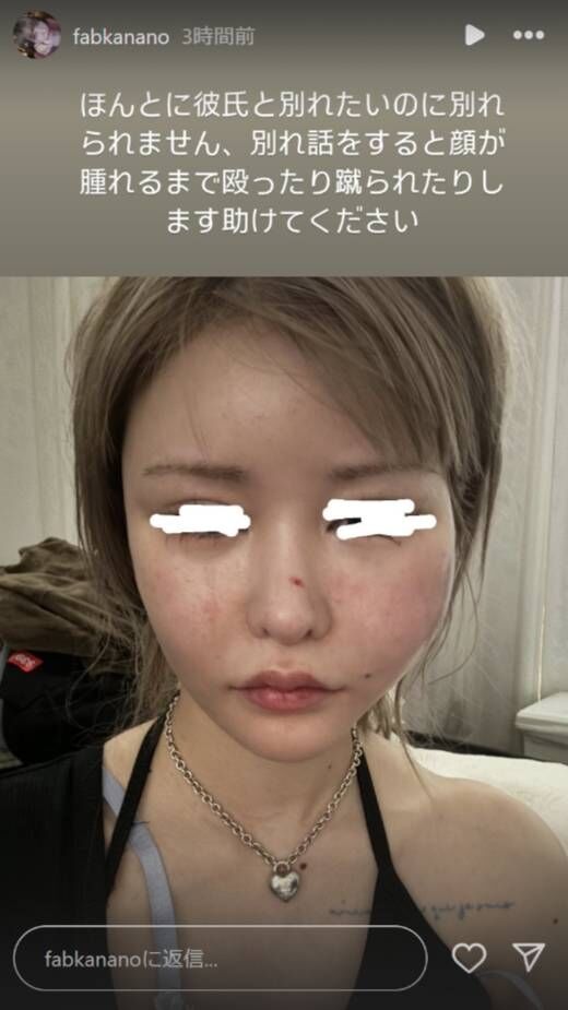 戦慄かなの、彼氏からの暴力を告白 「顔が腫れるまで殴ったり蹴られたりします」