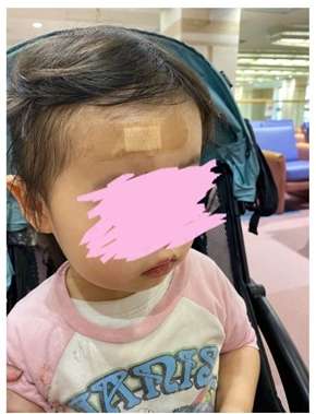 「やばい事になった」　光上せあら、自転車事故で2歳娘が顔面血まみれ　傷が残りかねない大けがに「整形につれていくから安心して」