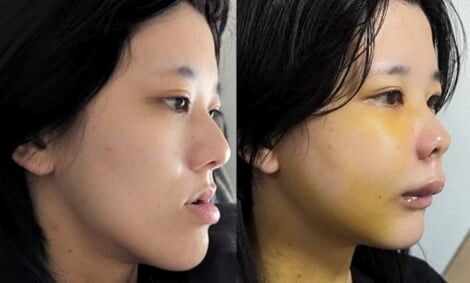 “人よりアゴが長い”をどうとらえる? 好きになる方法を模索する女性&武器に変えた男性…さまざまな容姿への価値観