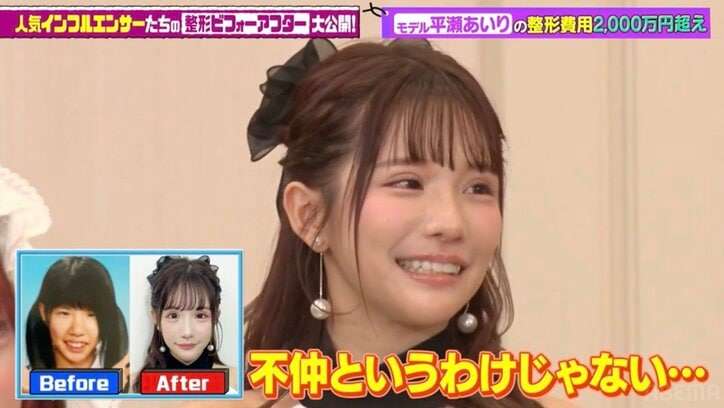 整形総額2千万モデル、離婚した父似の顔　母から「産まなきゃ…」　保育園でイジメ「この顔でいるなら」