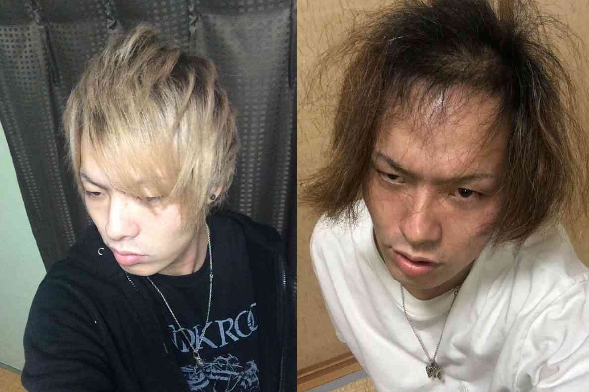 20代前半のころ「薄毛を隠していた」男性が、“隠さなくなってから”気づいたこと