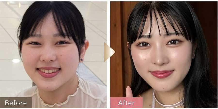 「もうやらない方がいい」　美容整形を繰り返す“整形沼”　経験20年以上の医師が語るリスクと限界