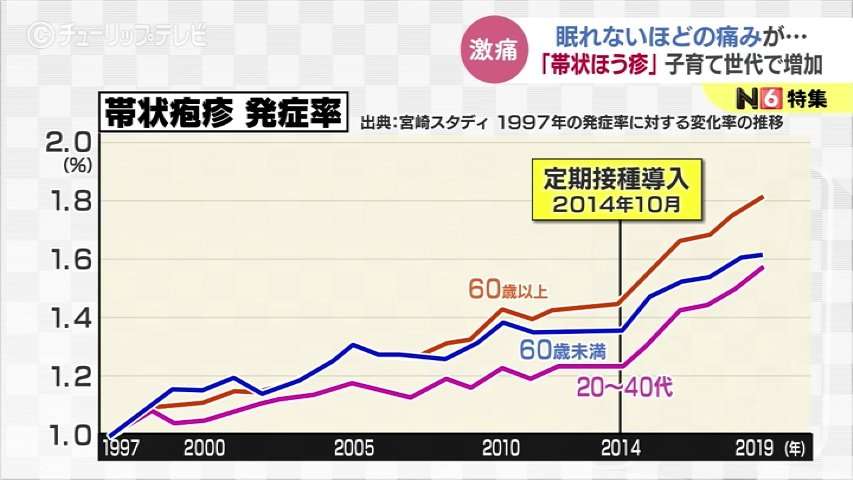 「耐えられない痛み」帯状疱疹が子育て世代で増加…顔に出ると神経麻痺も　2つのワクチン効き目は