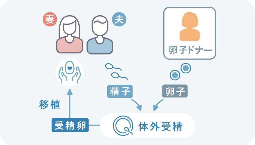 卵子提供どう思いますか？