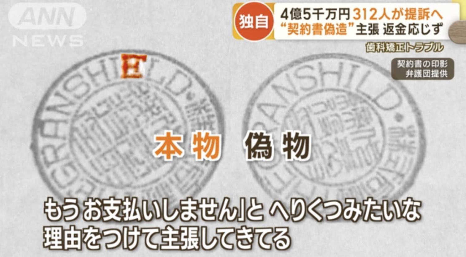 歯科矯正トラブルで涙の訴え　4億5000万円賠償求め　312人が集団提訴へ…新疑惑も浮上