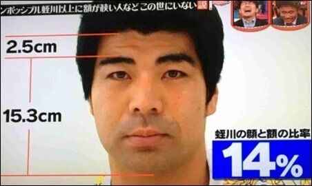 おでこが狭い方