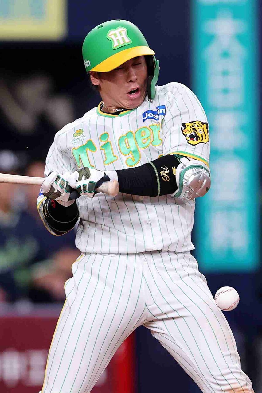 阪神・梅野が死球で骨折…ヤクルトの与死球数「48」に「マジで論外」SNSで怒り沸騰