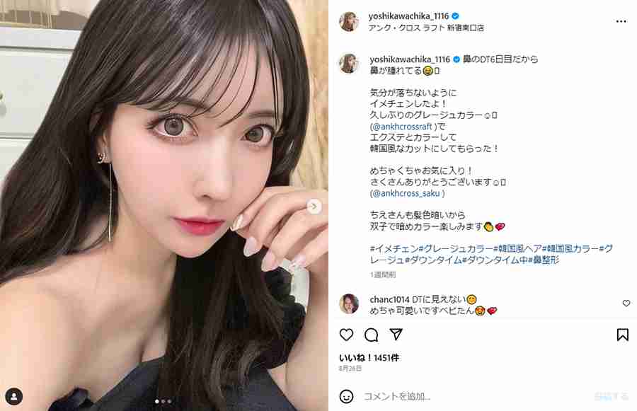 整形公表の双子モデル・吉川ちか、5度目の鼻の手術で「人生辛い」→「本当に辛い人に失礼」のコメントに反論「本音吐かせて」