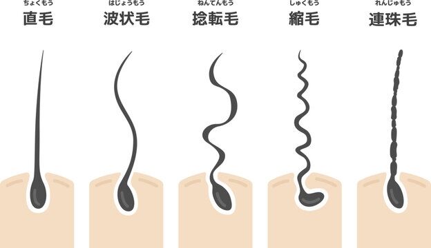 ちぢれ毛って神出鬼没じゃないですか？