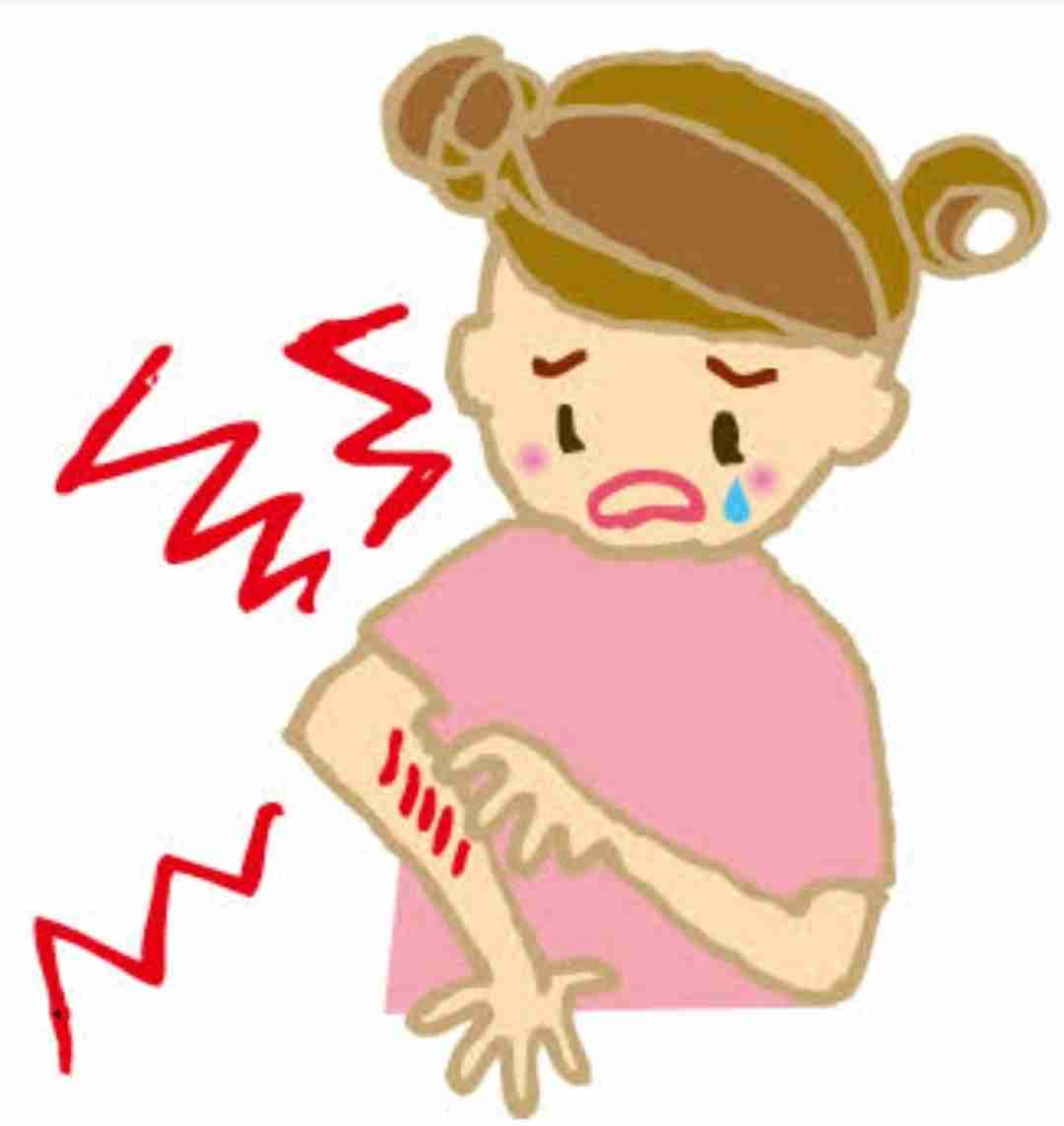 【雑談】冬のアトピーが辛い