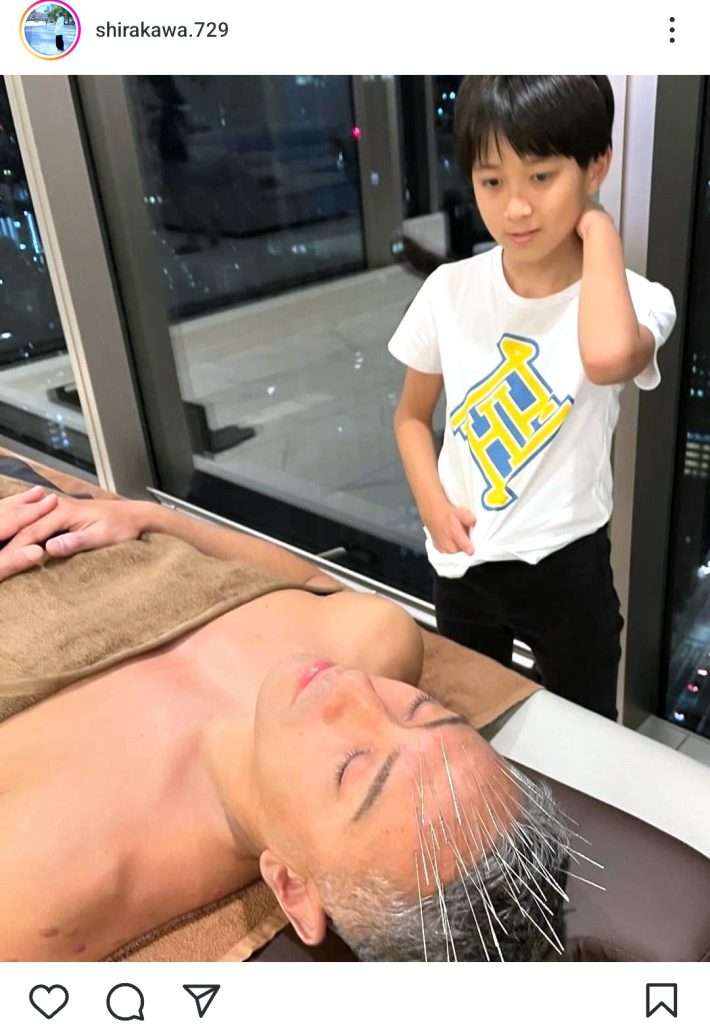 エグい…！窪田正孝に続いて團十郎らのハリだらけ写真も。“魂を浄化する”施術の謎ワールド