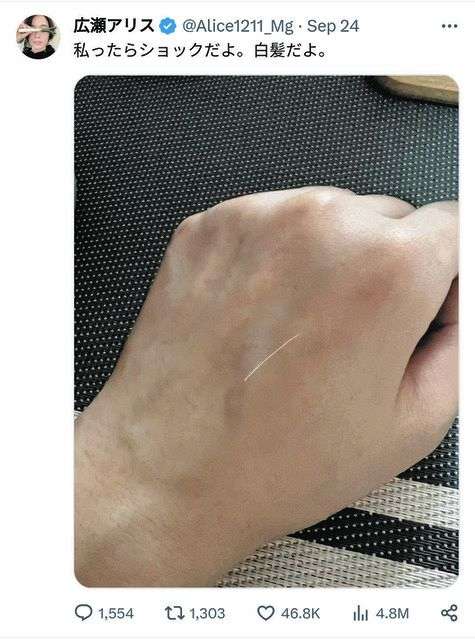 『私ったらショックだよ』広瀬アリスの白髪発見報告に「生きてる証拠」「大人の階段」と『励まし』の声