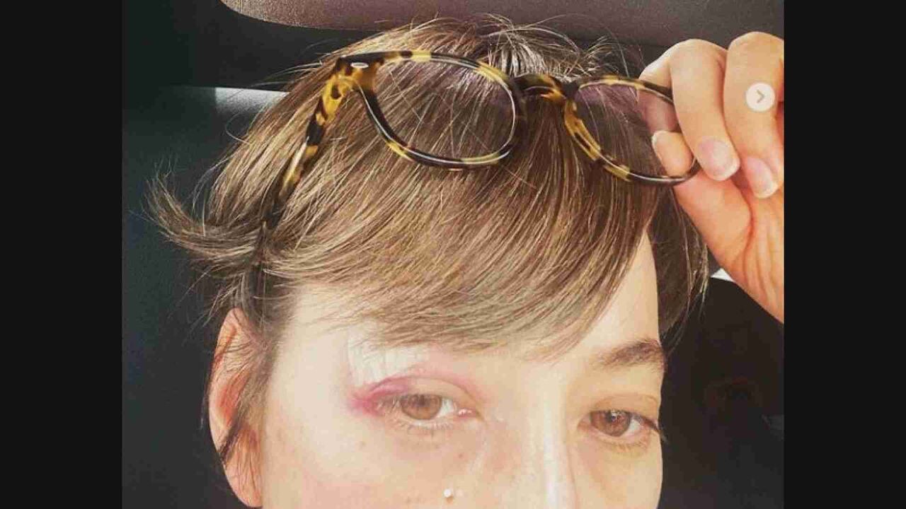 滝川クリステル、自転車で転倒し眉脇を10数針縫うケガ…「ヘルメットをしていれば」1日から努力義務化