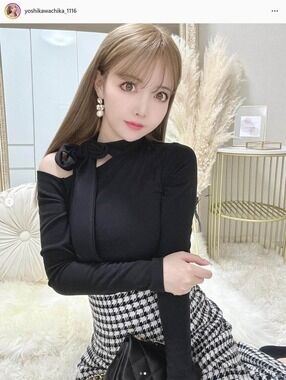 整形2000万モデル「顔太った？」に反論「腫れです」　3か月前に骨削り「半年から1年で完成する」