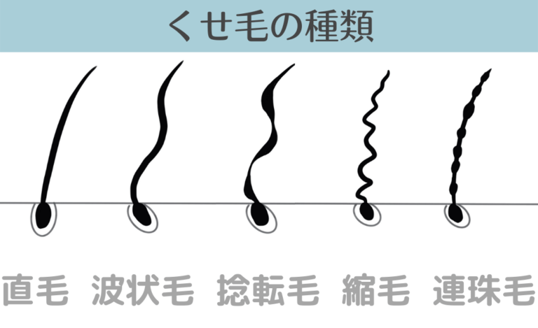 くせ毛(天パ)の人！