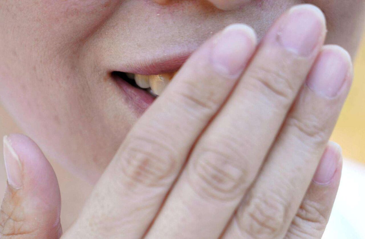 前歯と厚い唇、先生が描いた似顔絵にショック　外見が遺伝、整形した娘に複雑な母