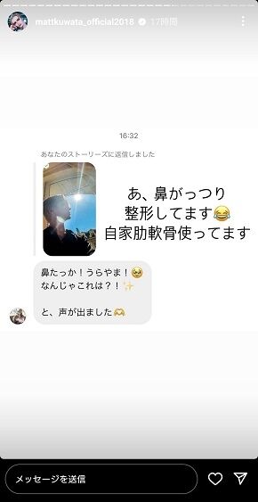Matt、さらりと「鼻がっつり整形してます」　きっかけはファンからのコメント