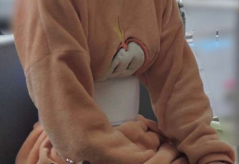 肋骨に激痛 → 身動き取れず“ポケモンのパジャマ”で病院へ行くことになってしまった人が話題に　「かわいそうなのに笑ってしまう」