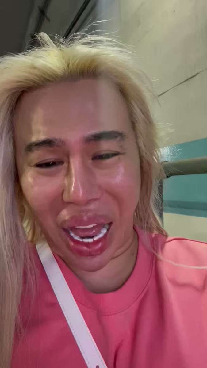 総額1億円の整形タレント　自転車で首都高誤進入しパニック「どうしたら…」警察車両が出口へ誘導