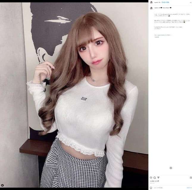 「整形して人生変わった」　人気インフルエンサーがビフォーアフター公開...激変ぶりにファン騒然「別人やん」