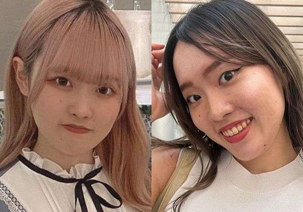 3回二重整形した女性が“一重に戻した”ワケ「他人の価値観で自分を傷つけていたのが本当に馬鹿らしくなった」