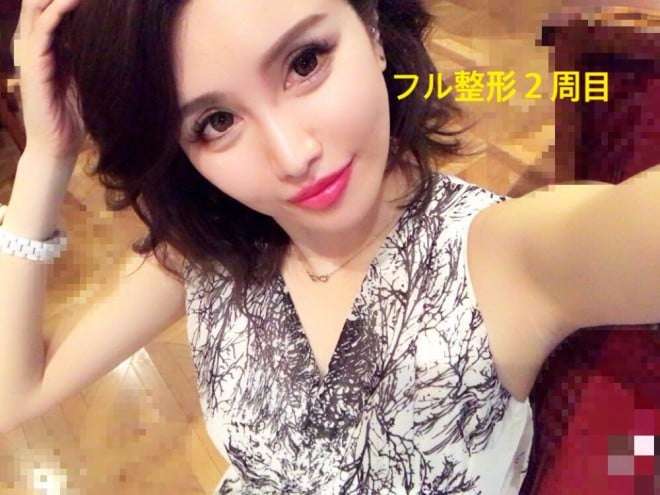 【整形美女】「これ以上施術できないのは辛い」「今でも鏡の中の自分に絶望する」整形を繰り返す女性たちの美への執念