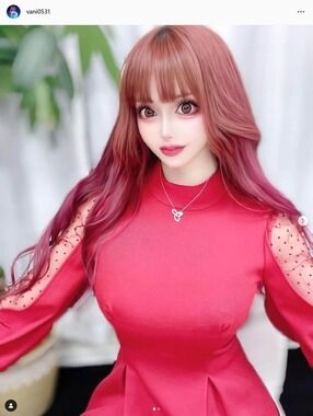 整形後トラブルで再手術も...「またお金払わされた」「こっち負担なんだ」　3億円整形タレント泣き寝入りの過去