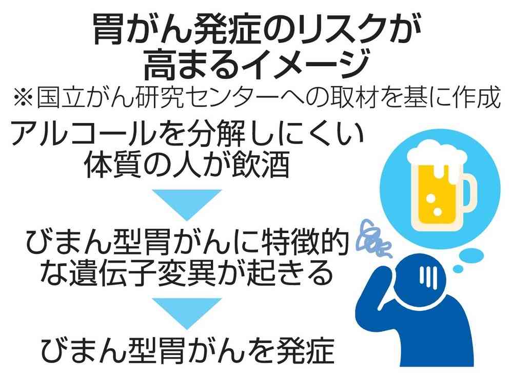 酒弱い人、胃がん発症リスク高く　遺伝子解析で関連判明