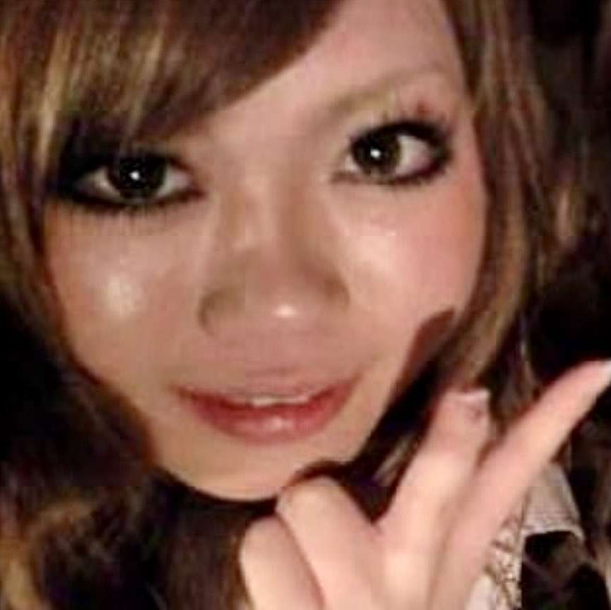 「美人ってすごい！」整形総額2000万円超えの女性が“人生が180度変わった”と感じた瞬間