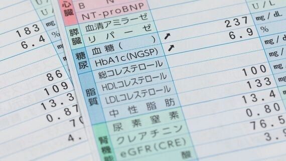 労働者の6割が健康診断｢異常あり｣の深刻な事態 しかも｢要再検査を放置している人｣が約半数も