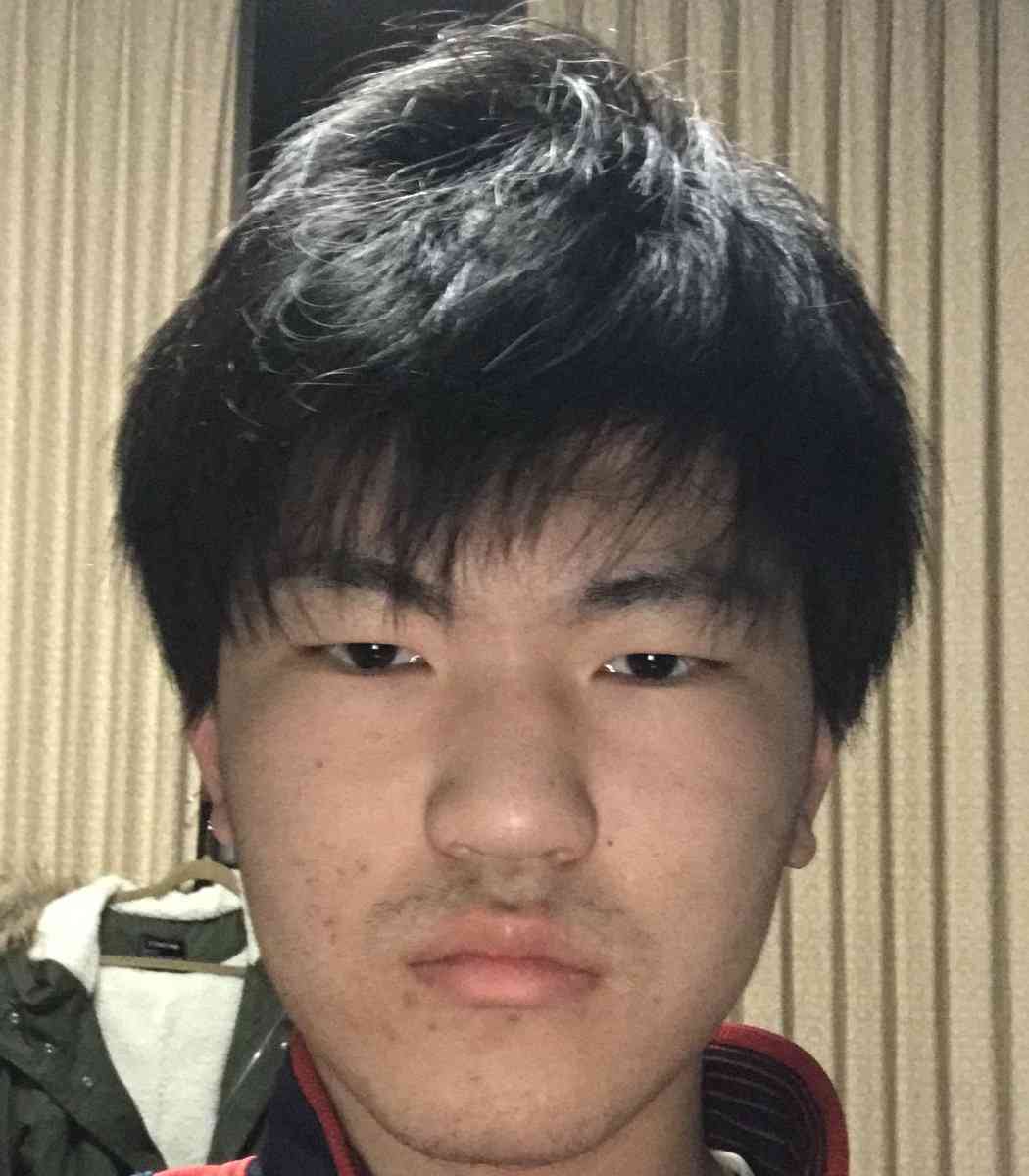 「僕にとって整形は“ブスを治すもの”」　300万かけて韓国で全顔フル整形した男性、綺麗な容姿を得て確信した“世の理不尽”