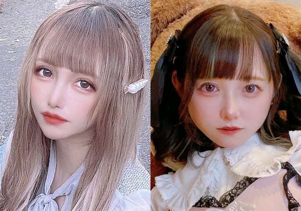 整形で“可愛さ”を手に入れた41歳、小5で施術した元アイドル…美貌以上に変化したものとは？