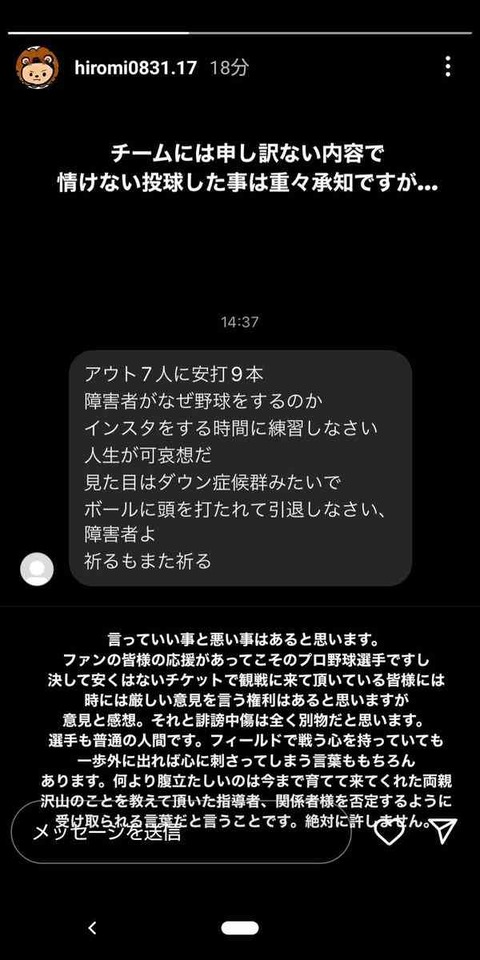乃木坂46賀喜遥香　1カ月休養を報告「一定期間休息をとって体調を回復する期間が必要だと」