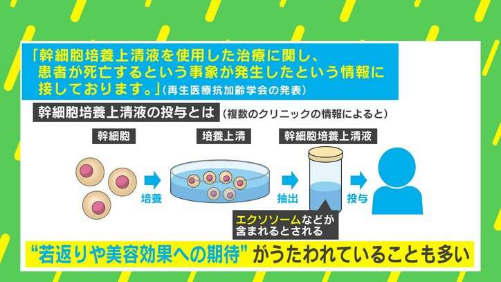 幹細胞培養上清液で死亡例　研究者「エクソソームの投与で何かを治したと人で実証された例はない」「身体にリスクも」 “若返りや美容効果”うたうクリニックに警鐘