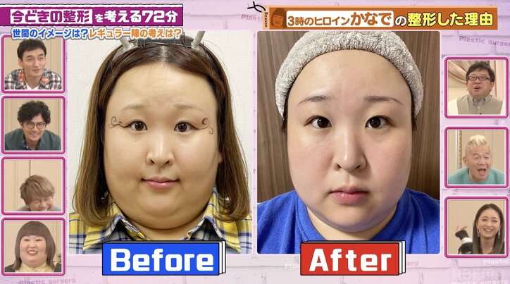 3時のヒロイン・かなで、整形ビフォーアフターを公開「そのクリニック、バズる！」整形総額6000万円・福岡みなみも絶賛