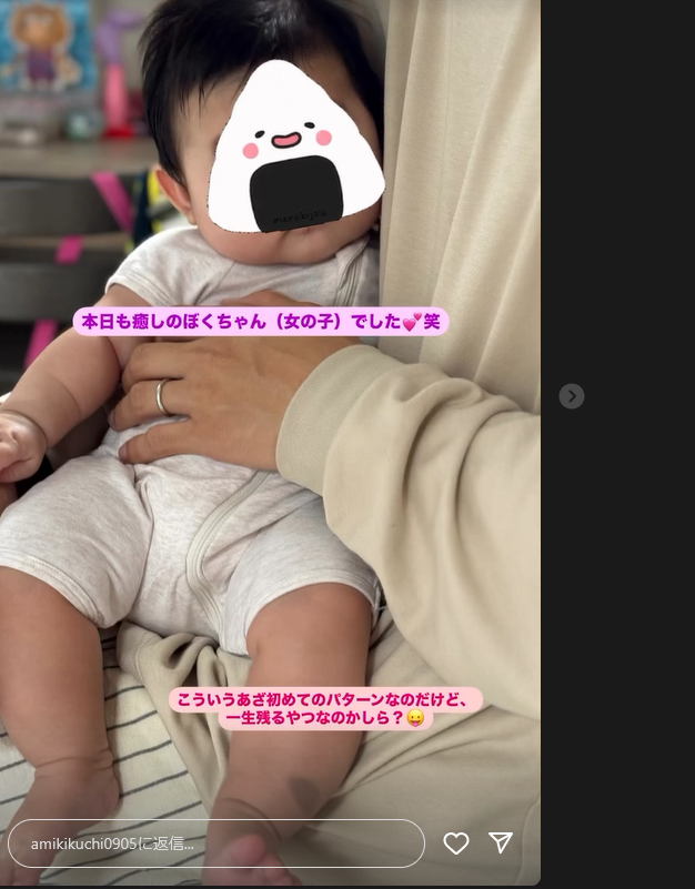 菊地亜美　次女の足にあざ「一生残る？」に反響　夫の「レーザーで取れる」に嫌悪感も「沢山いてびっくり」