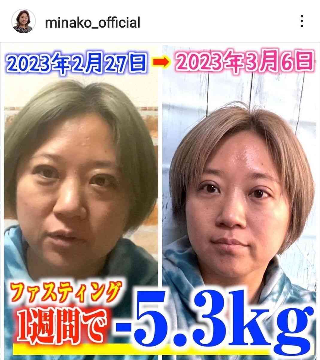 体重82キロ超→激痩せの「ビッグダディ」元妻・美奈子、激変した40歳近影！4回結婚し8人出産