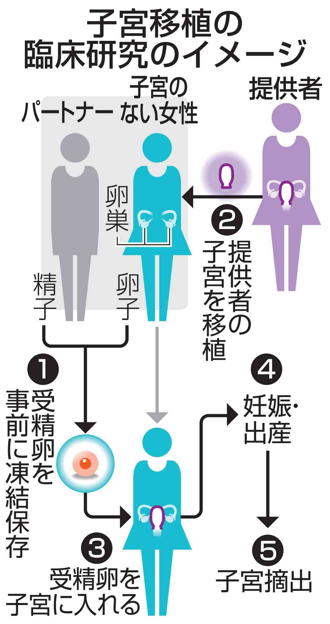 藤田医大、子宮移植計画を申請　出産目的、実現すれば国内初
