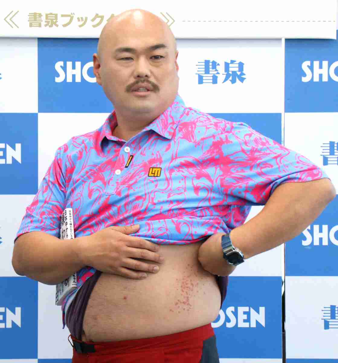 クロちゃん、“毎日会ってる”新恋人・リチとの交際でじんましん発症中「彼女が寝ている側のおなかに」