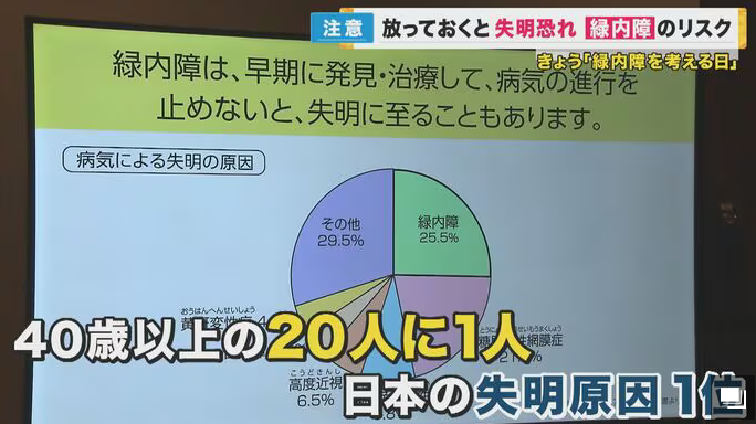 40歳以上の20人に1人「緑内障」　気づかぬうちに進行し失明の原因1位　『眼底検査』による早期発見を