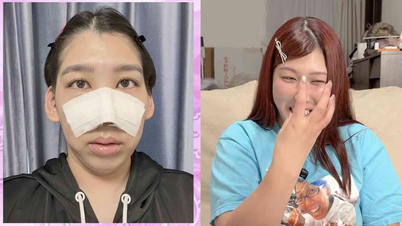 ゆめっち　自身の整形箇所＆金額ぶっちゃけ　鼻の形を参考にした女優の名も明かす