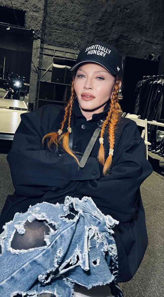 マドンナは整形手術の不評にショック　「前の顔を復元する」と米誌が報道