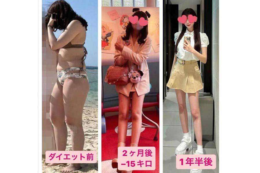 整形に300万円、減量15キロで壮絶過去と決別　一変した男性の目「180度扱いが変わりました」