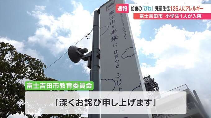 学校給食で『びわ』提供　児童生徒126人にアレルギー反応　1人が入院　山梨
