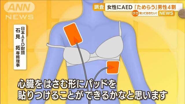 女性に“AED”　男性4割「ためらう」　上半身裸に抵抗　専門家「必ずしも…」