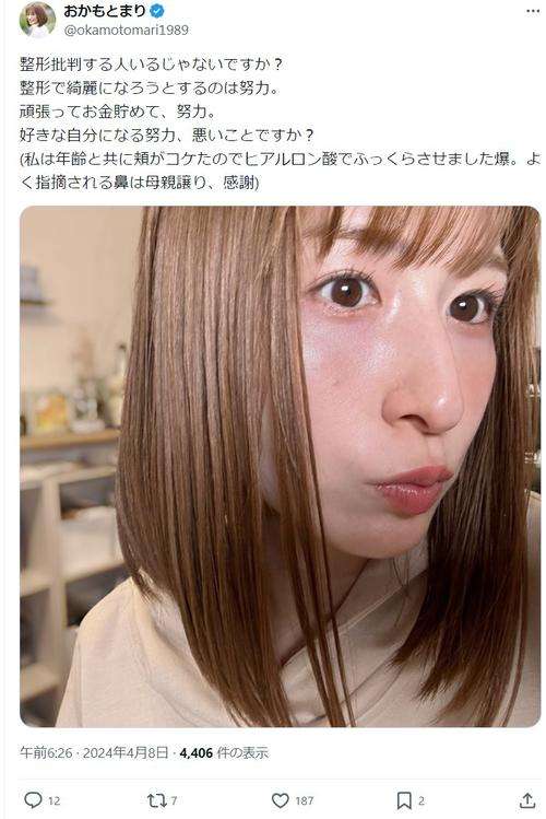 おかもとまりさんが整形批判に反論「綺麗になろうとするのは努力」　ヒアルロン酸施術歴明かす