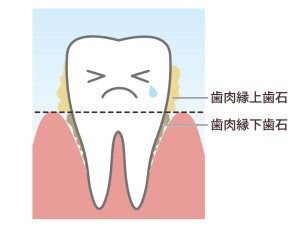 【愚痴】歯科の通院辛い人！1ヶ月励まし合おう【弱音】