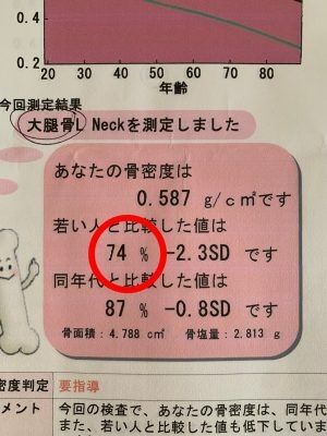 52歳編集者が絶望、1年コツコツ治療してもこの結果？閉経前後の女性の「ホネのヤバさ」の話を聞いてくれないか