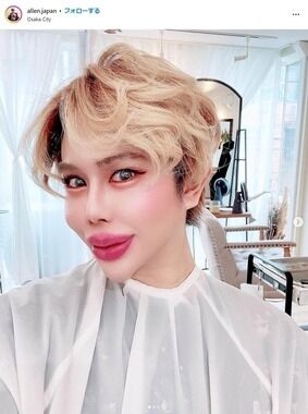 「日本一の整形男子」アップデート報告が物議　「やりすぎ」指摘相次ぐも...医師反論「他人が横から口を出すのは違う」