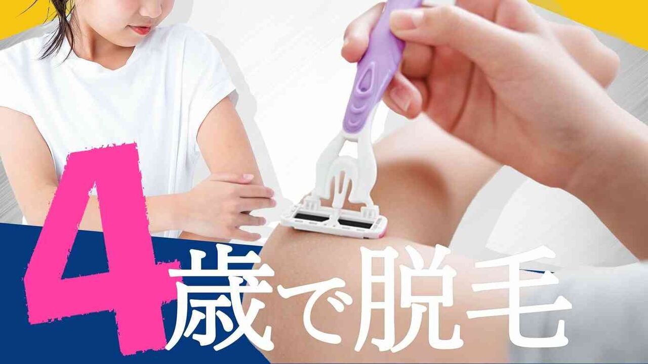 4歳が脱毛サロンに通う　きっかけは保育園で言われた何気ない一言　「気持ち悪い」